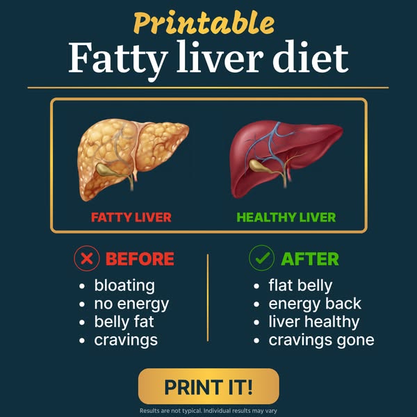 Start Liver Detox today!
