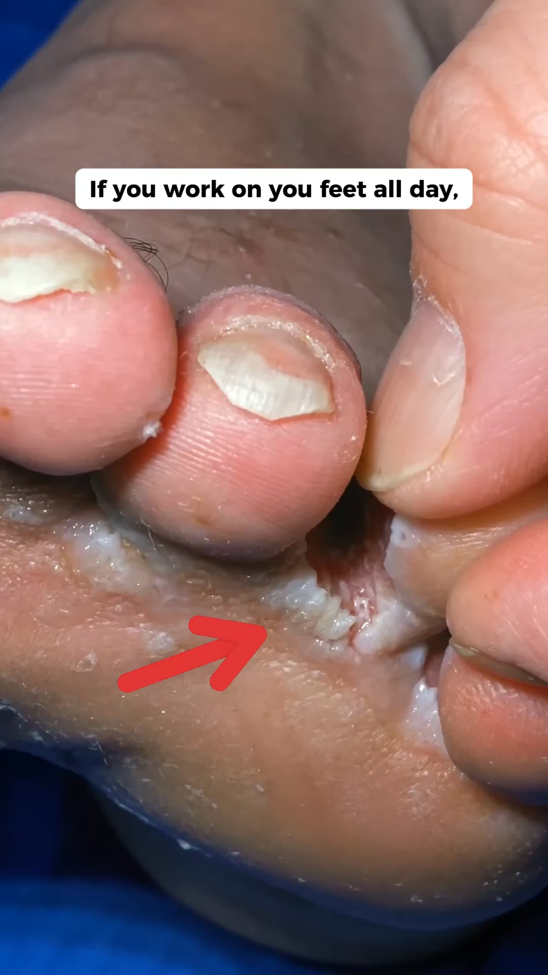 That's Not Dry Skin