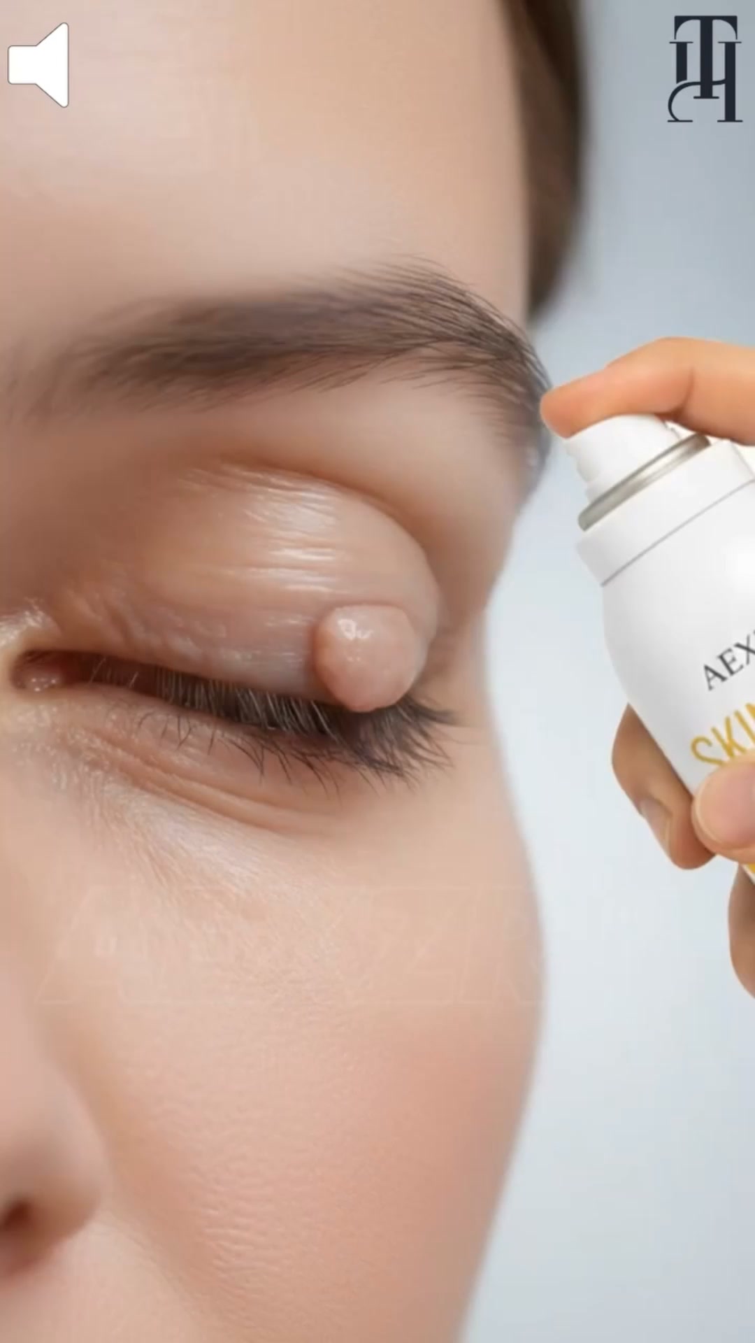 Fast & Easy Fix For Skin Tags