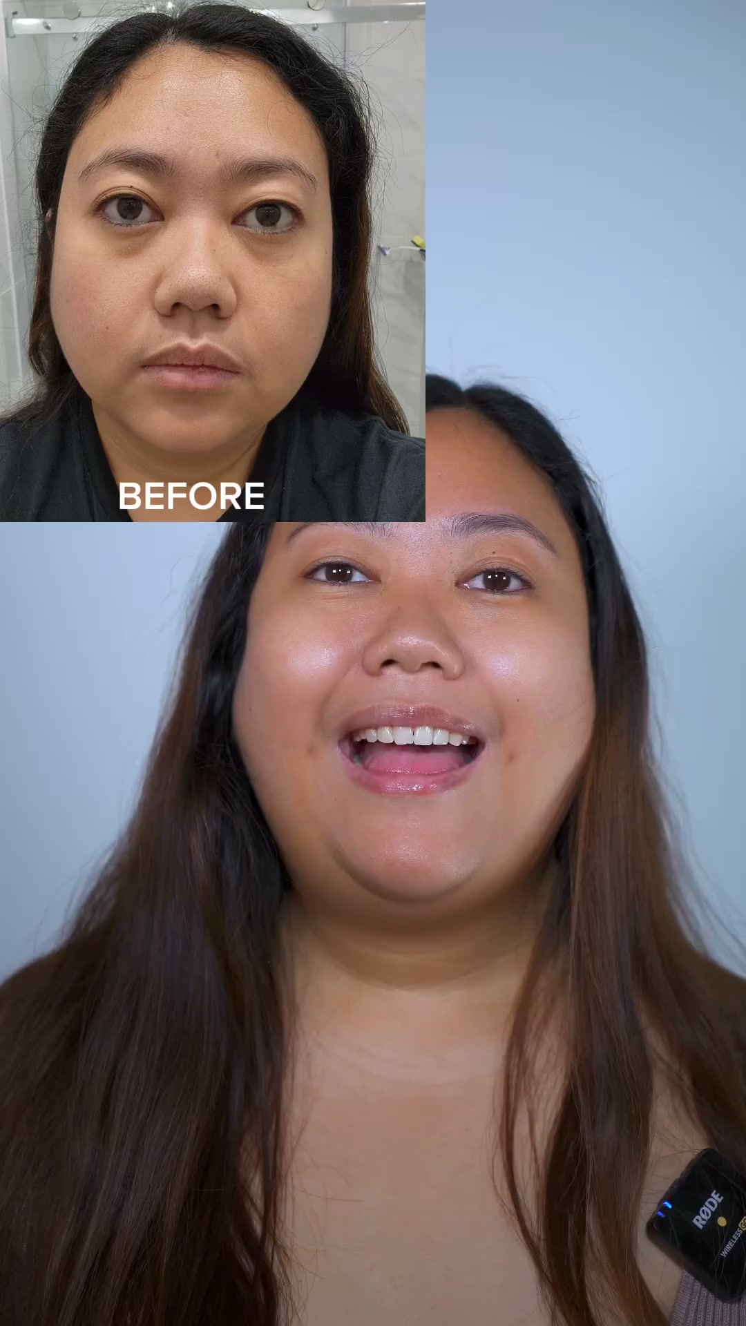 Hooded eyes, Smile lines, Jowls, Eye bags, Double chin