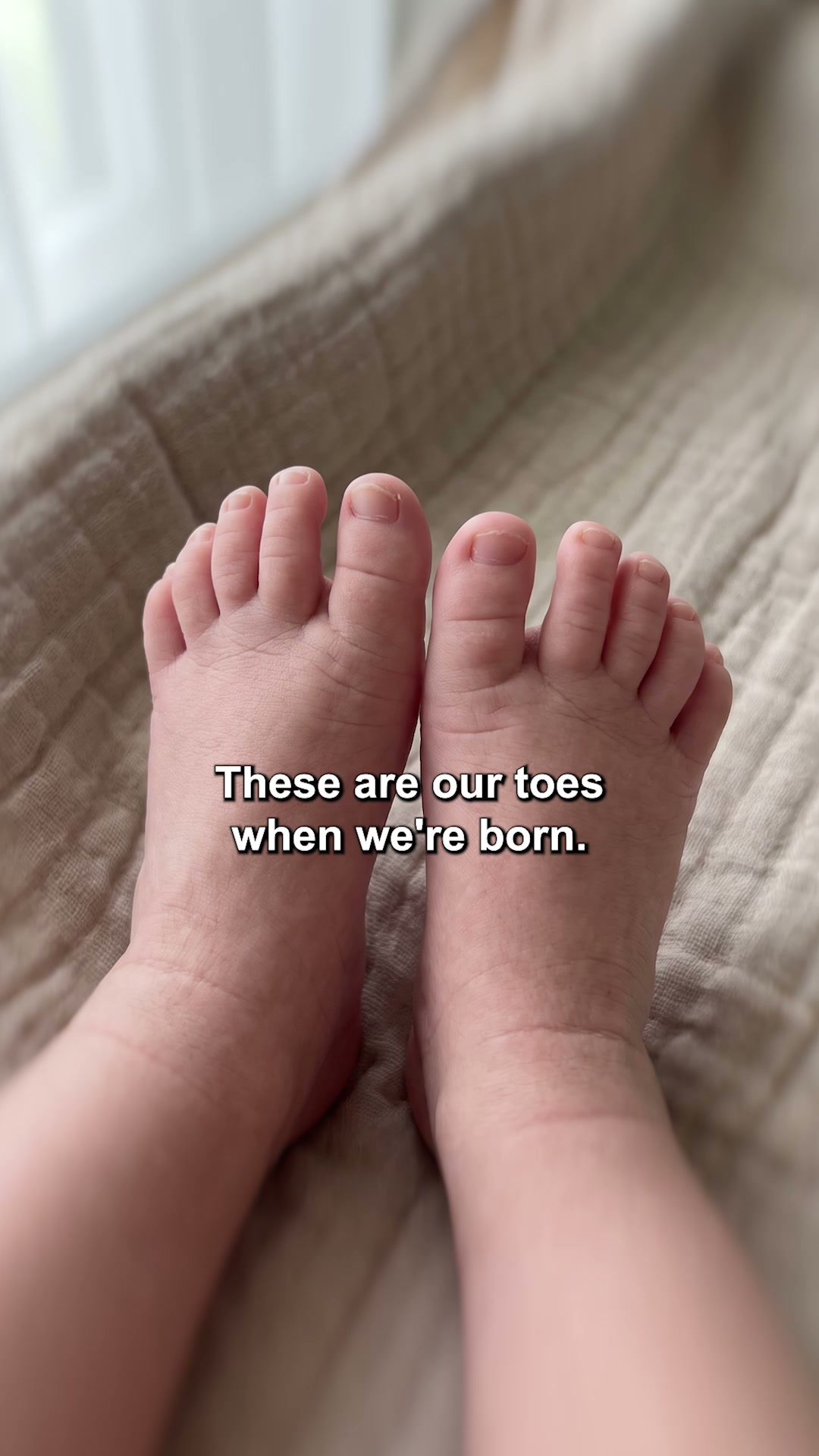 If you cut a bunion off, it grows back