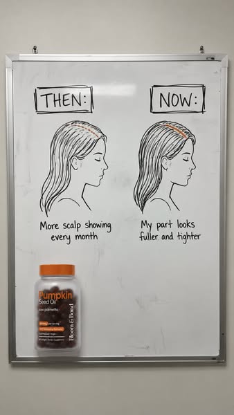 Help Hair Loss Naturally