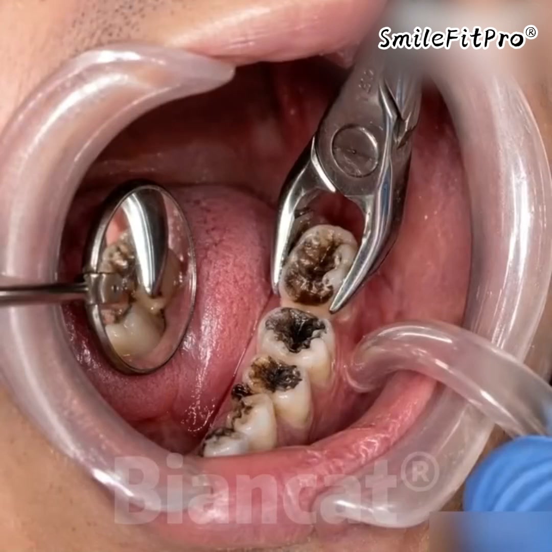 Meet the Next Generation of Daily Oral Care