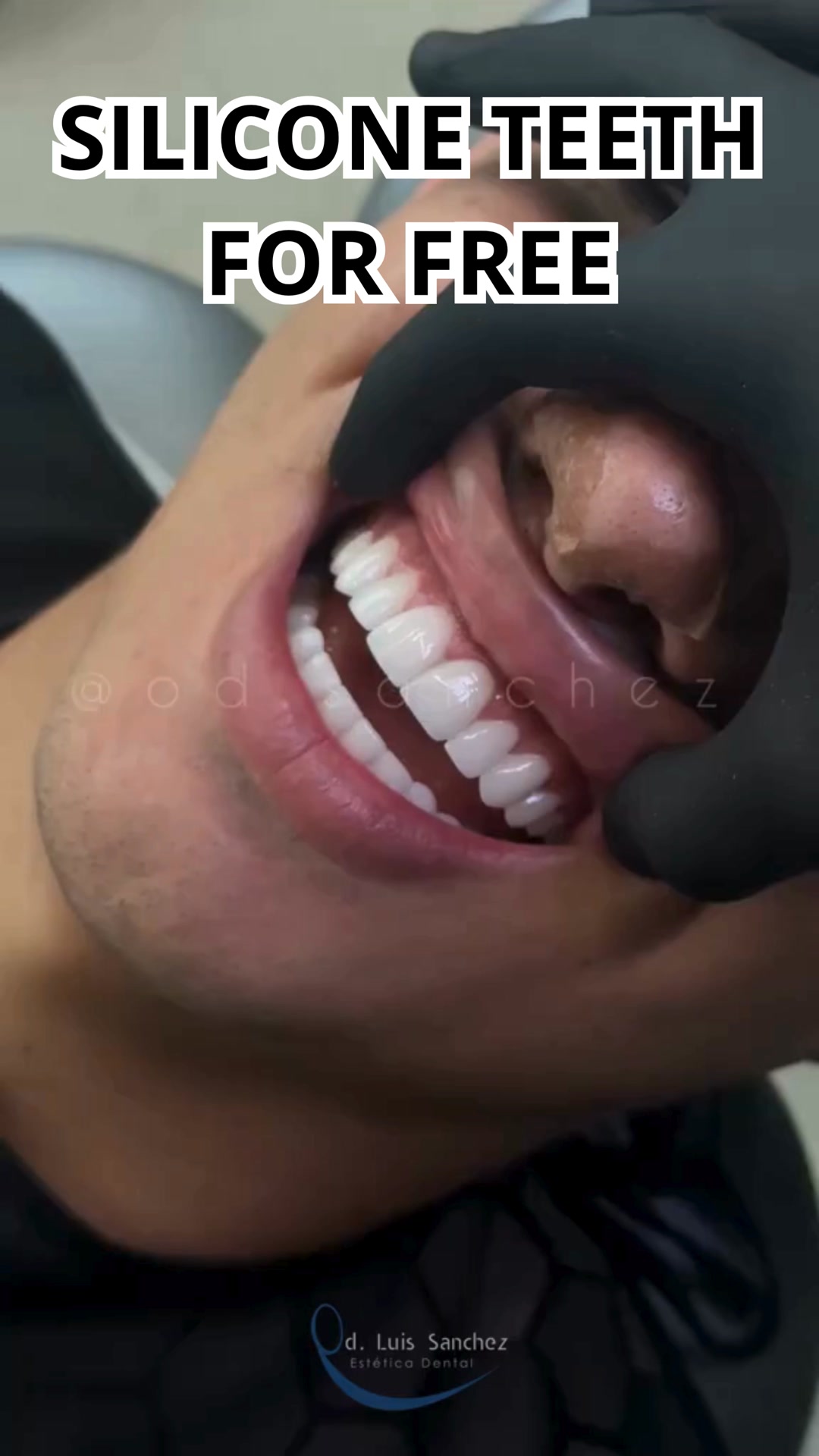 I WANT FREE SILICONE TEETH
