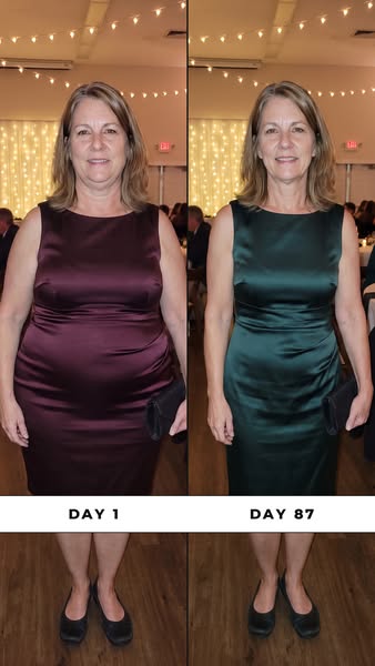 Day 1 vs Day 87