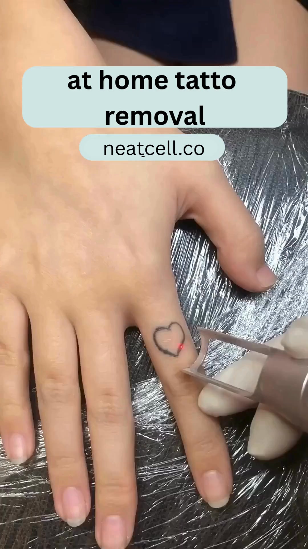 Anúncio de Neatcell Pen