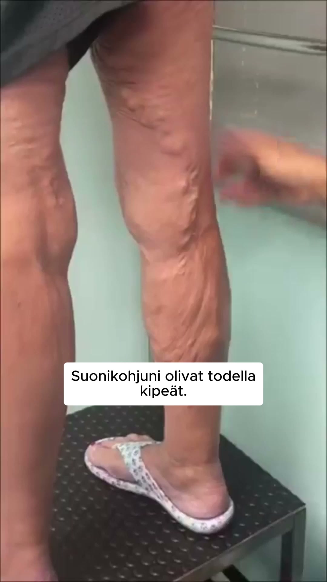 Väsyneet, turvonneet jalat? FlowSocks™ ratkaisee sen vaivattomasti! 4.8/5