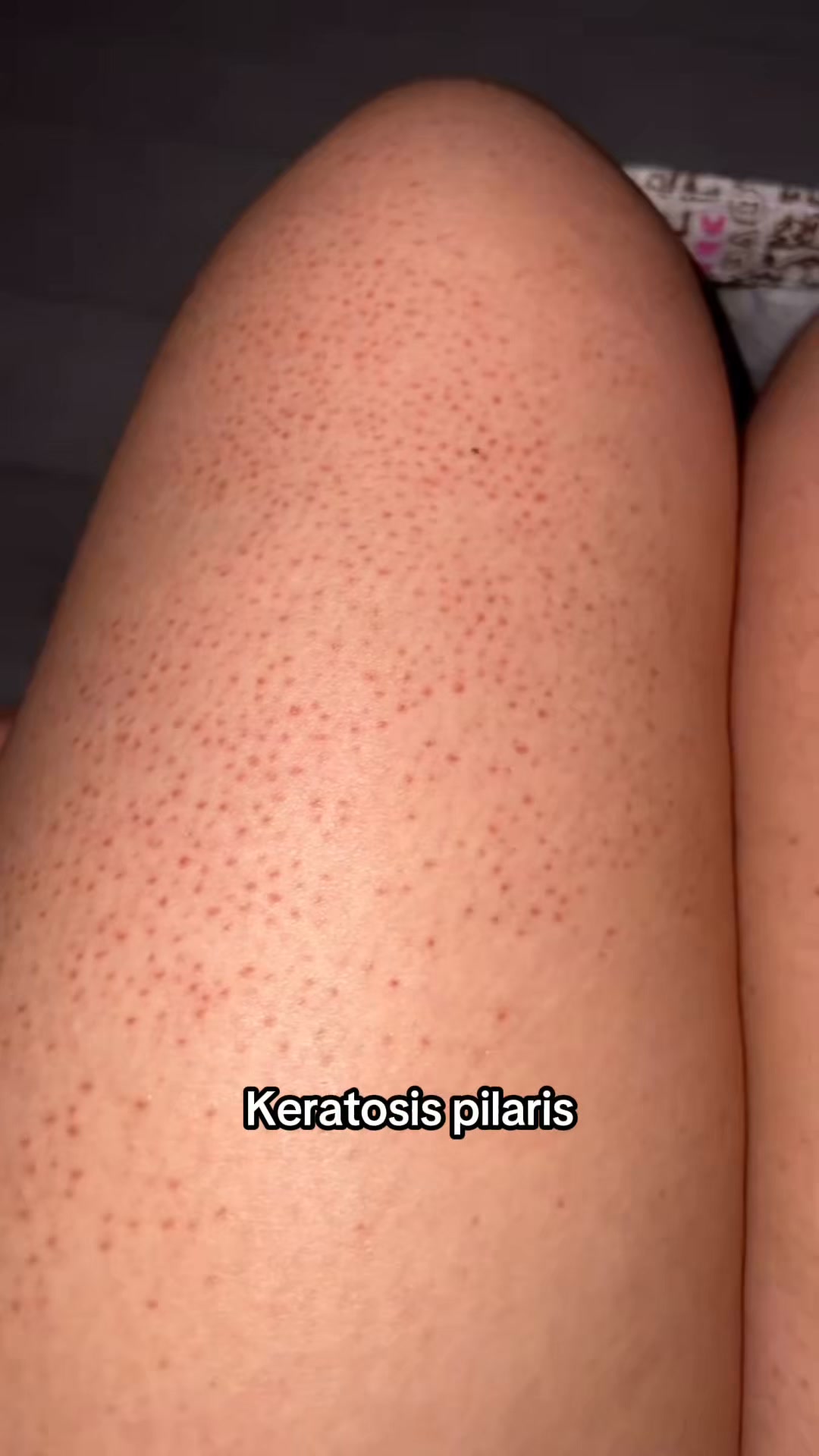 Betala senare med Klarna