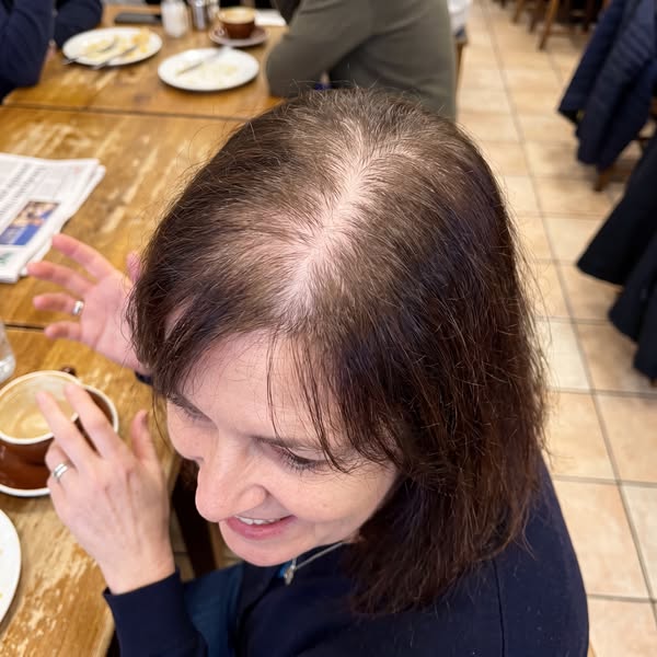 Every Woman With Thinning Hair Needs To Read This