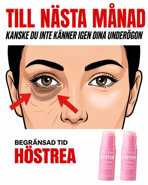 Trött på fina linjer?