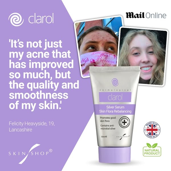 Say Goodbye to Acne – Hello Healthy Skin!