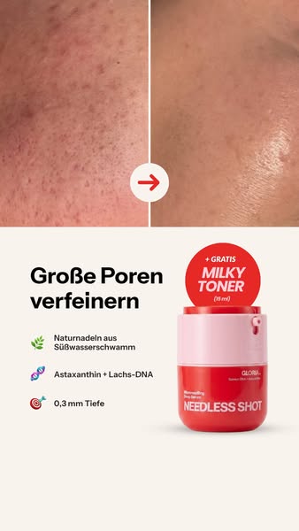 Große Poren loswerden? 2026 geht das von zu Hause.