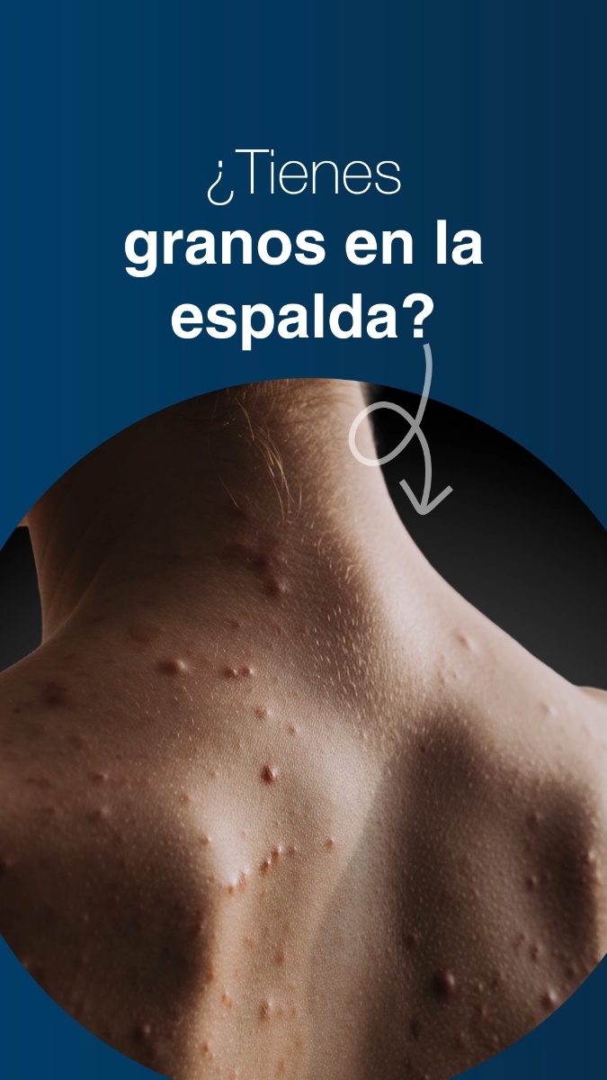 Consigue una piel clara y suave en los glúteos