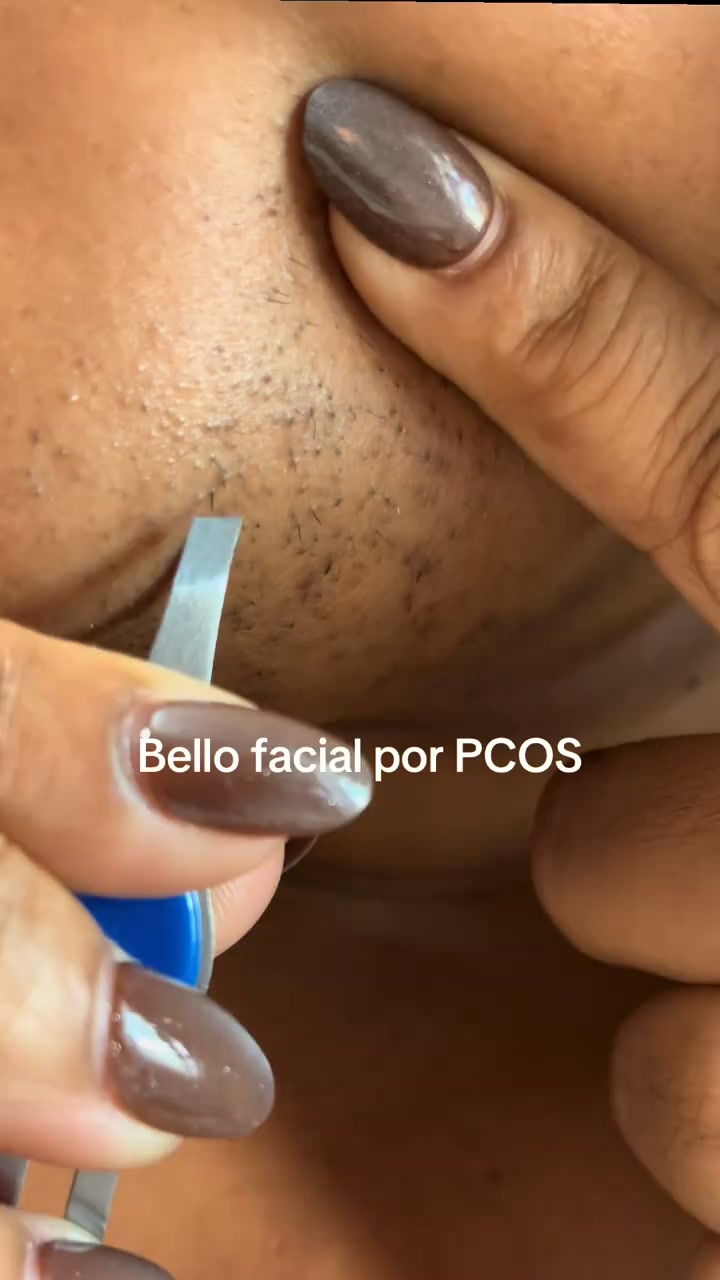 Detén el vello con esta raíz extraña
