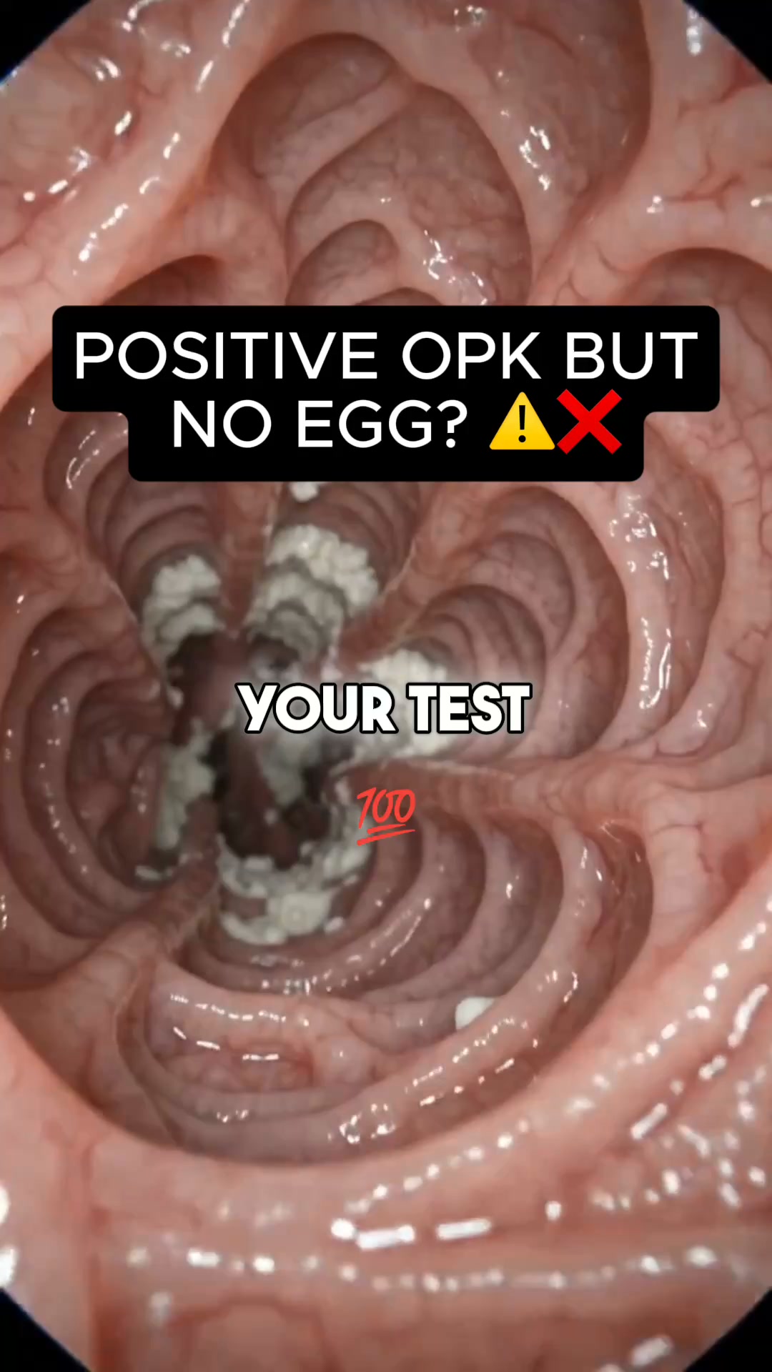Take the Free Fertility Quiz