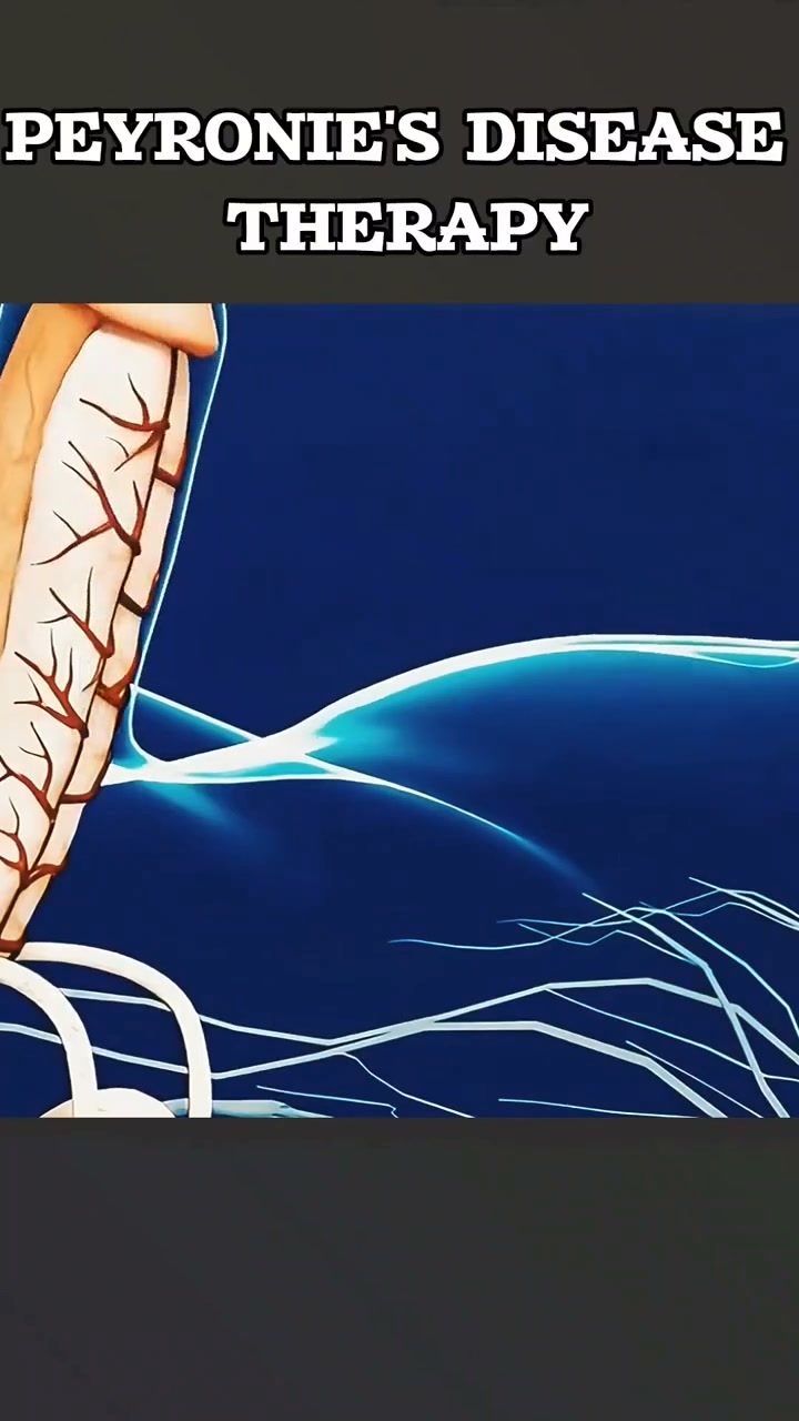 Your Manhood Runs on Blood Flow. Restore It.