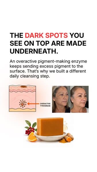 Fade Dark Spots From Within