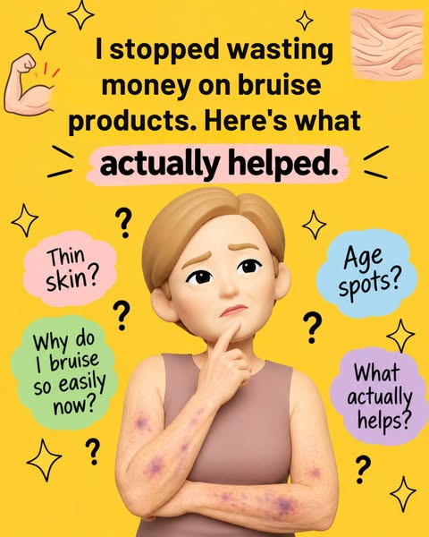 Why Bruise Products Are A Scam