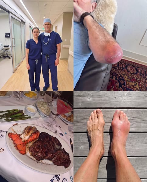 Read this if you deal with gout flare-ups