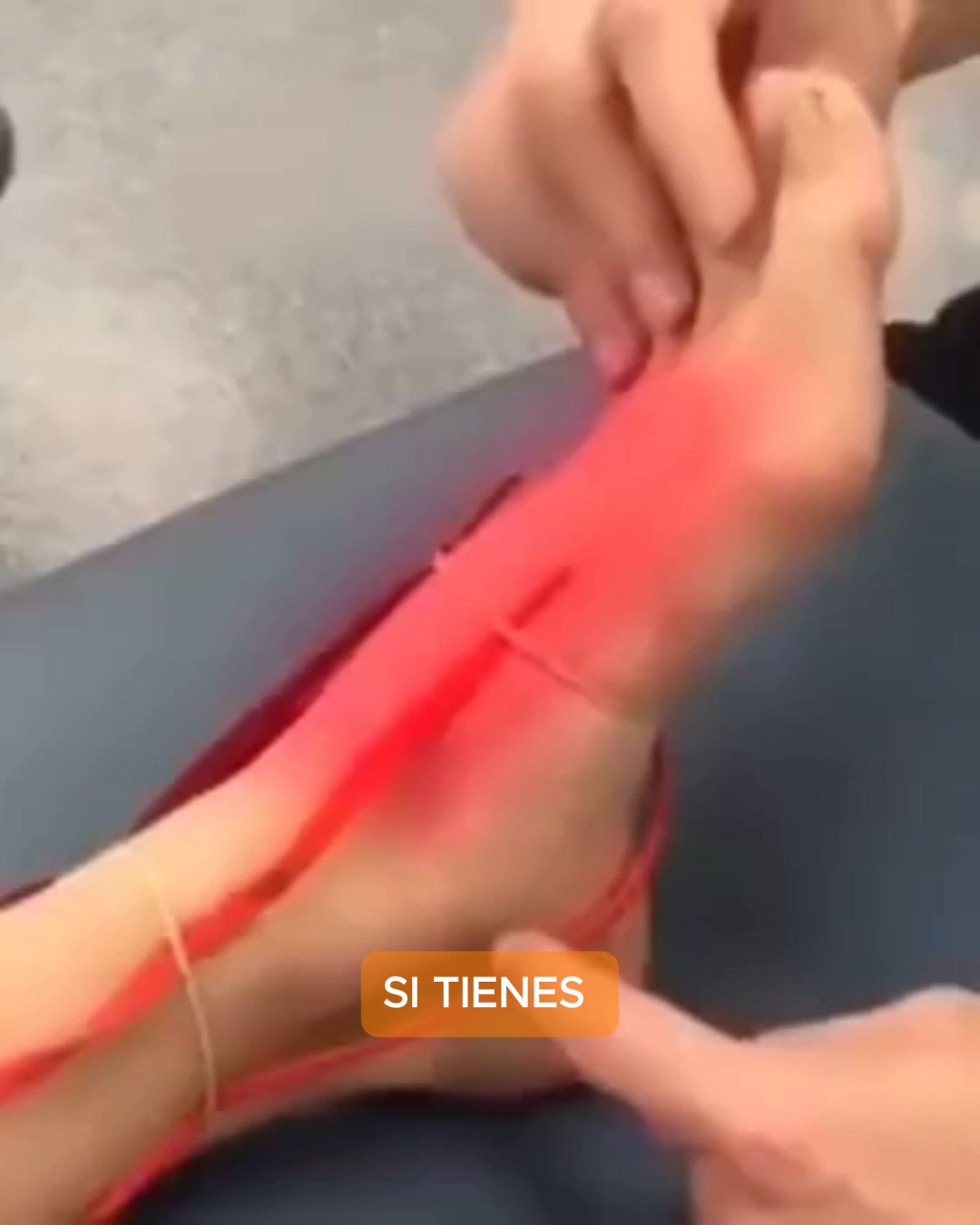 Alivia el dolor de neuropatía de forma natural