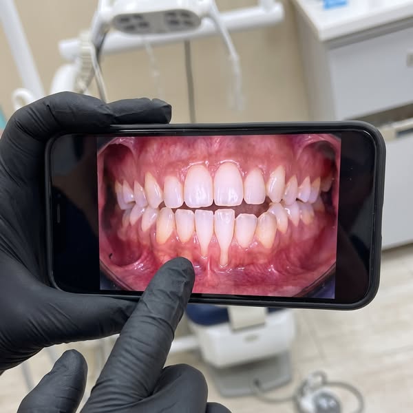 She flossed every day... her teeth came out anyway
