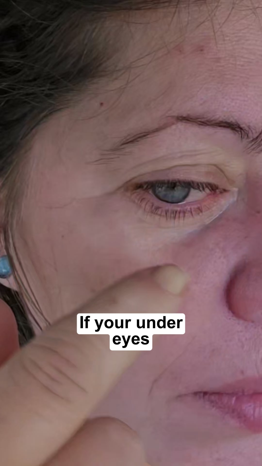 Dry-under eyes? (apply this for 7 days)