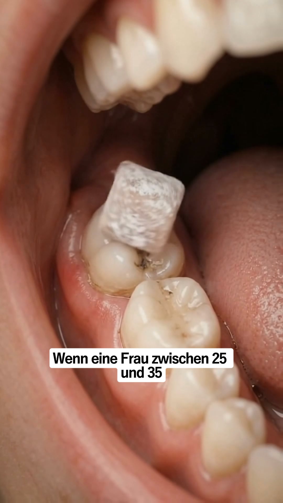 1 Kaugummi, der deine Zähne verändert.