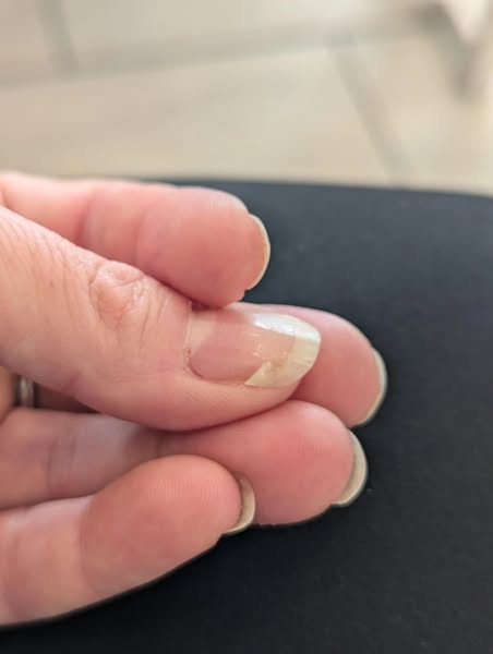Read this if your nails are splitting...