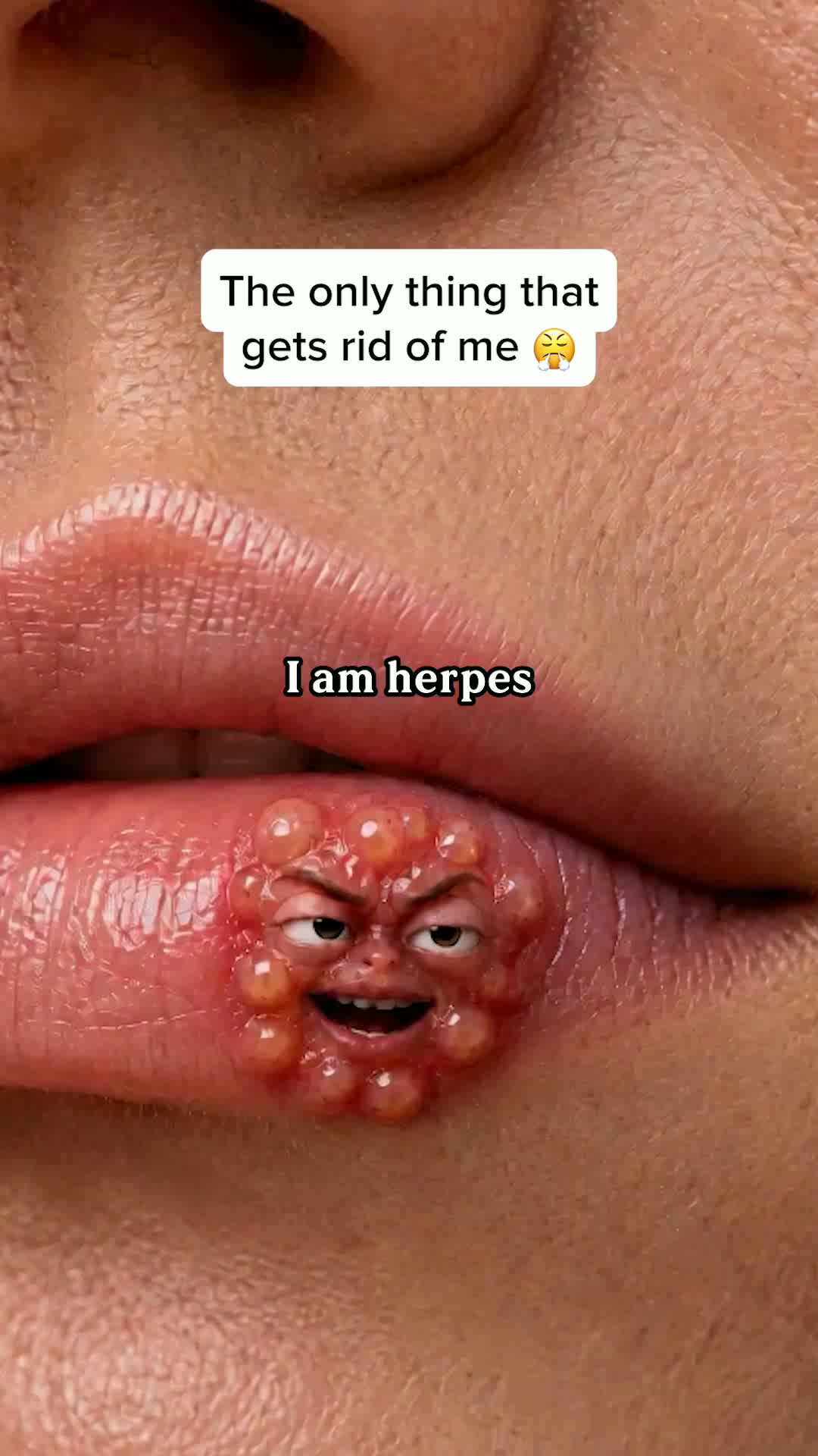 BUY 1 GET 1 FREE