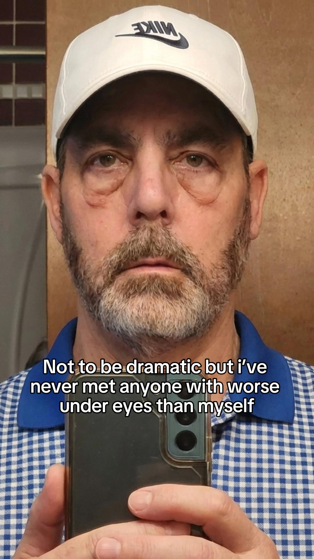 Skip surgery, try this instead