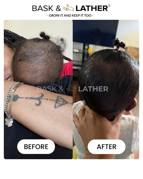 Hair Growth Stimulator