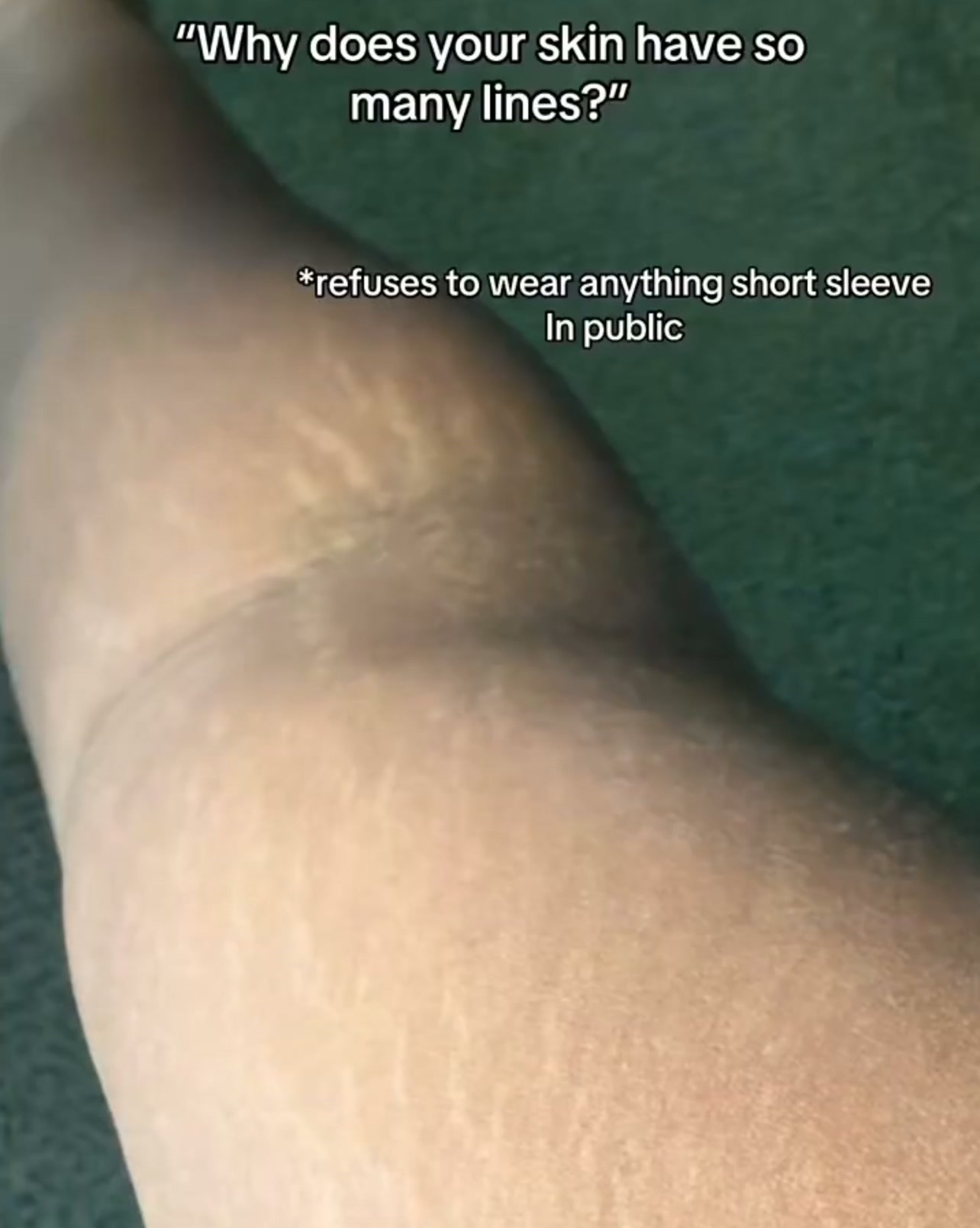 Smoother Skin in 4 Weeks