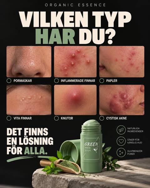Minska akne naturligt