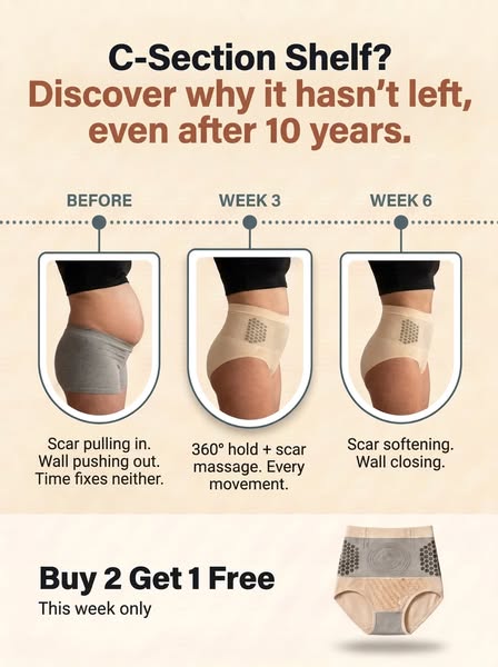 Why your c-section shelf won't leave.