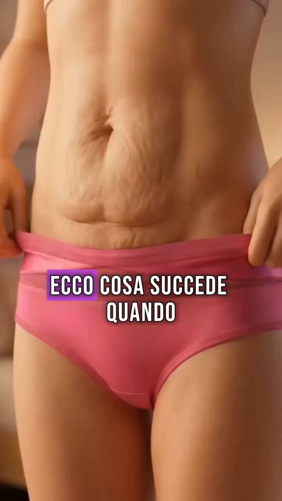 Slip modellanti specifici per il parto cesareo