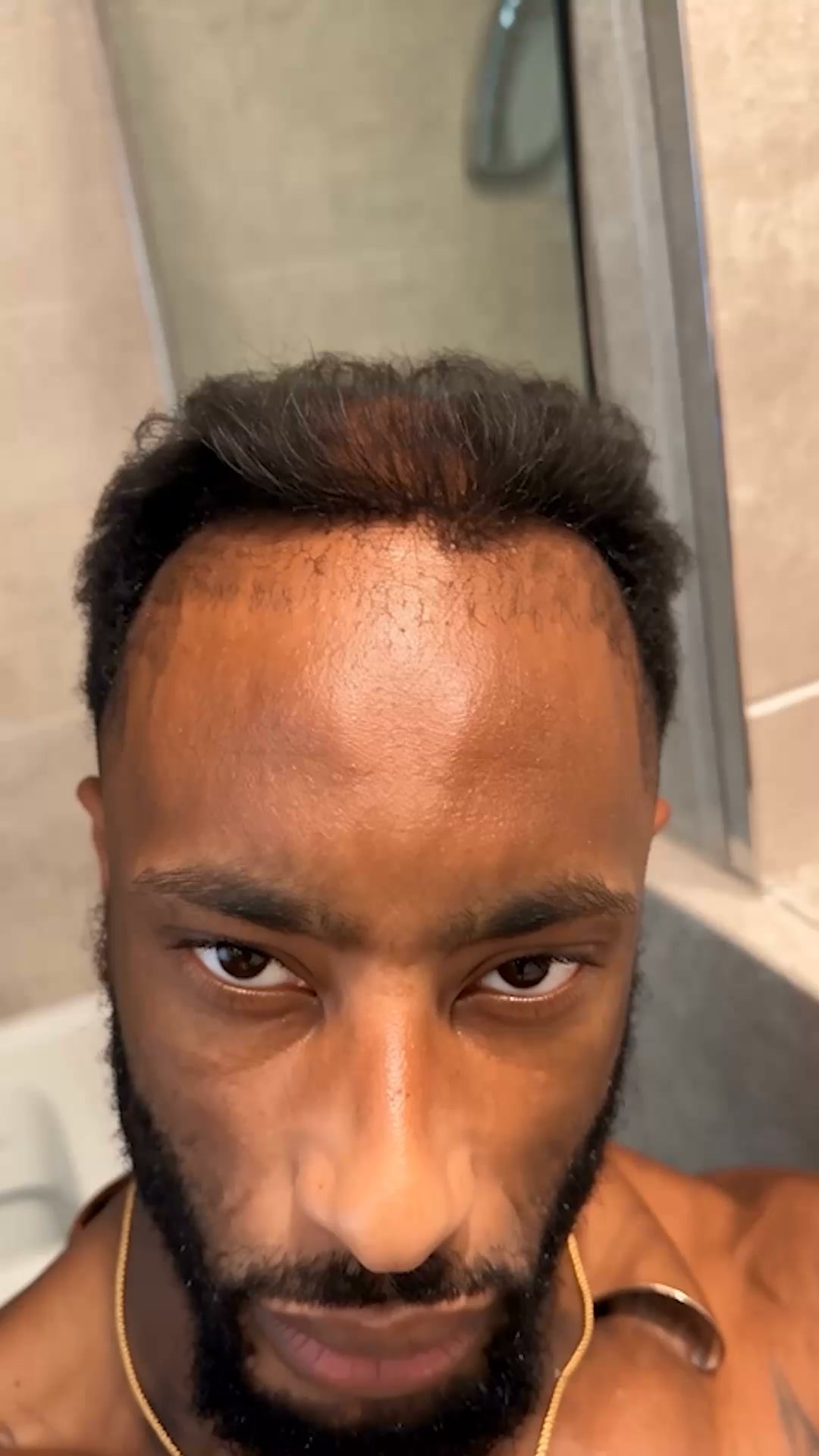 Restore your hair!