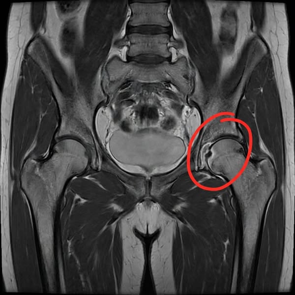 If you’re struggling with joint pain, this is how I...