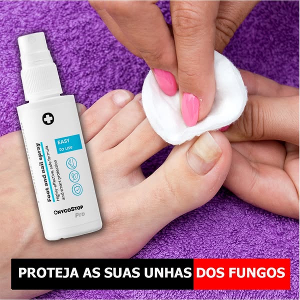 Diga adeus aos embaraçantes fungos nas unhas
