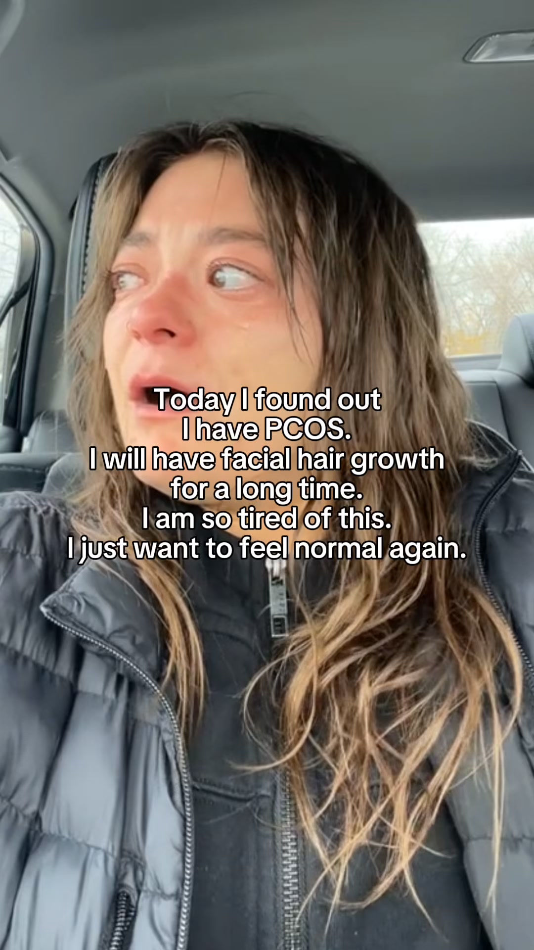 Hair Removal That Works