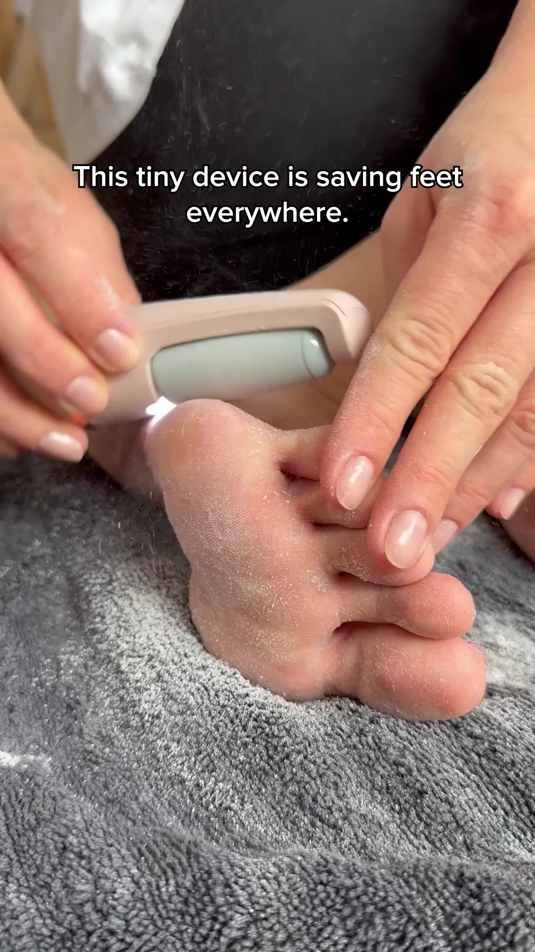 Smooth feet. In minutes. Guaranteed.
