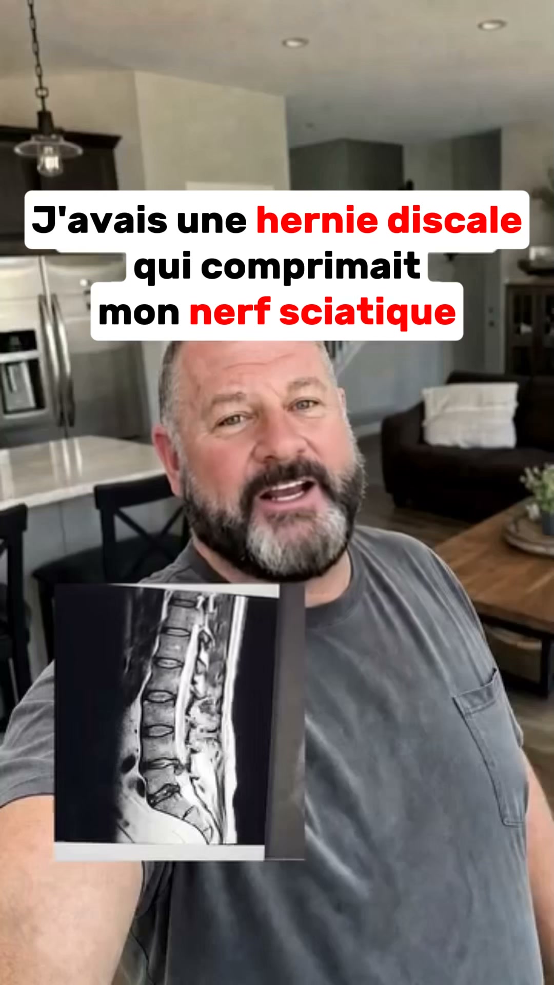 3 façons de soulager la douleur sciatique