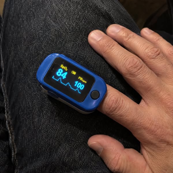 Read This If Your Oxygen Keeps Crashing