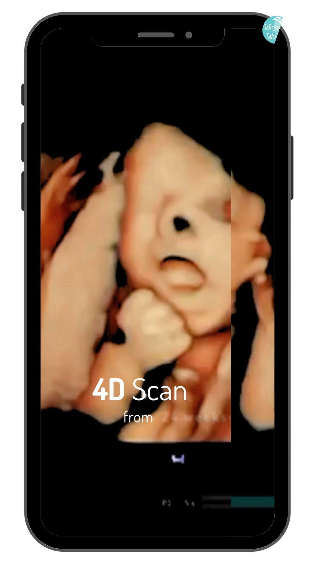 4D Scan from 24 weeks+ | Same day appointments available