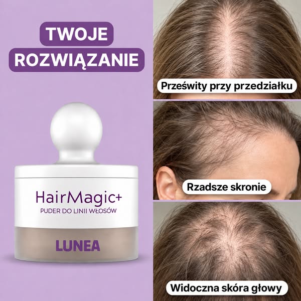 Przestań sprawdzać prześwitującą skórę na włosach