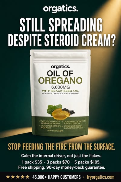 Stop the Cream-and-Flare Cycle
