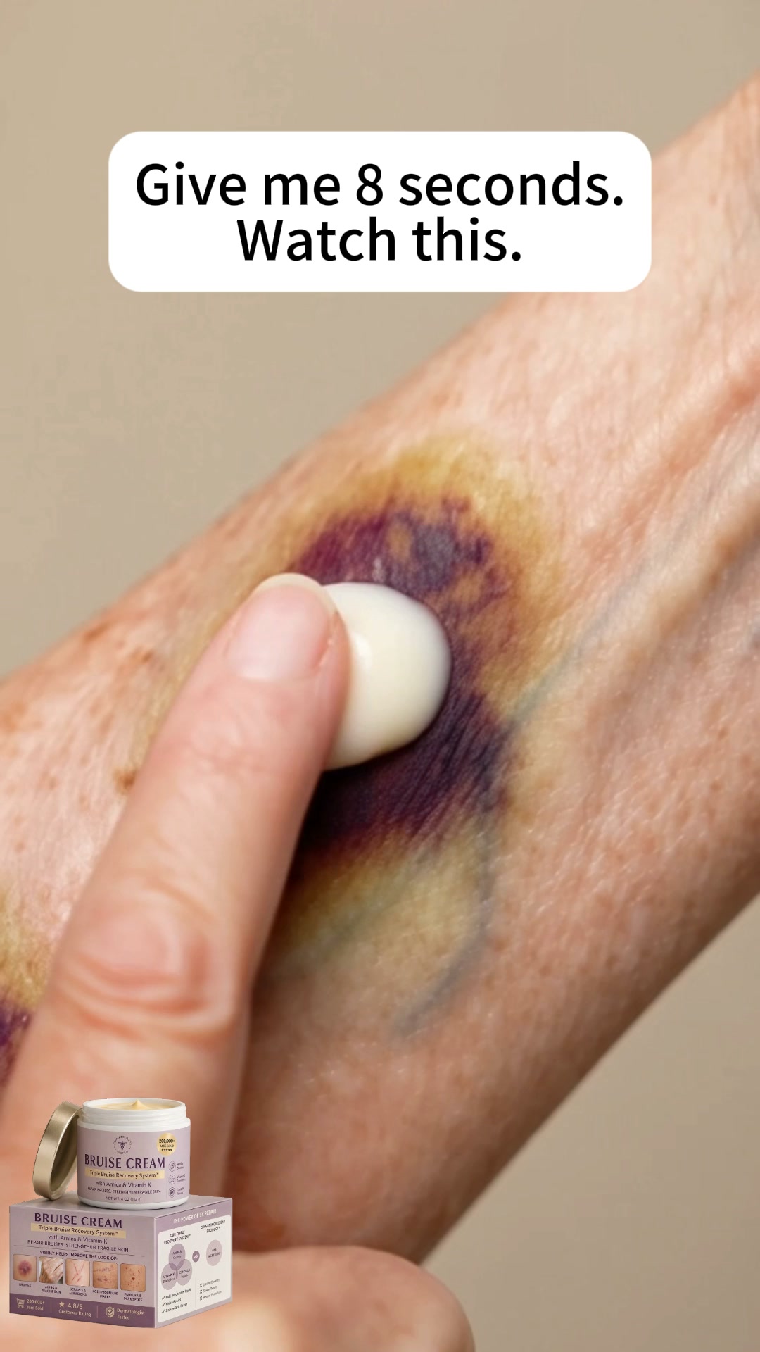 New Upgraded Version - Bruise Cream to repair bruises and strengthen the skin
