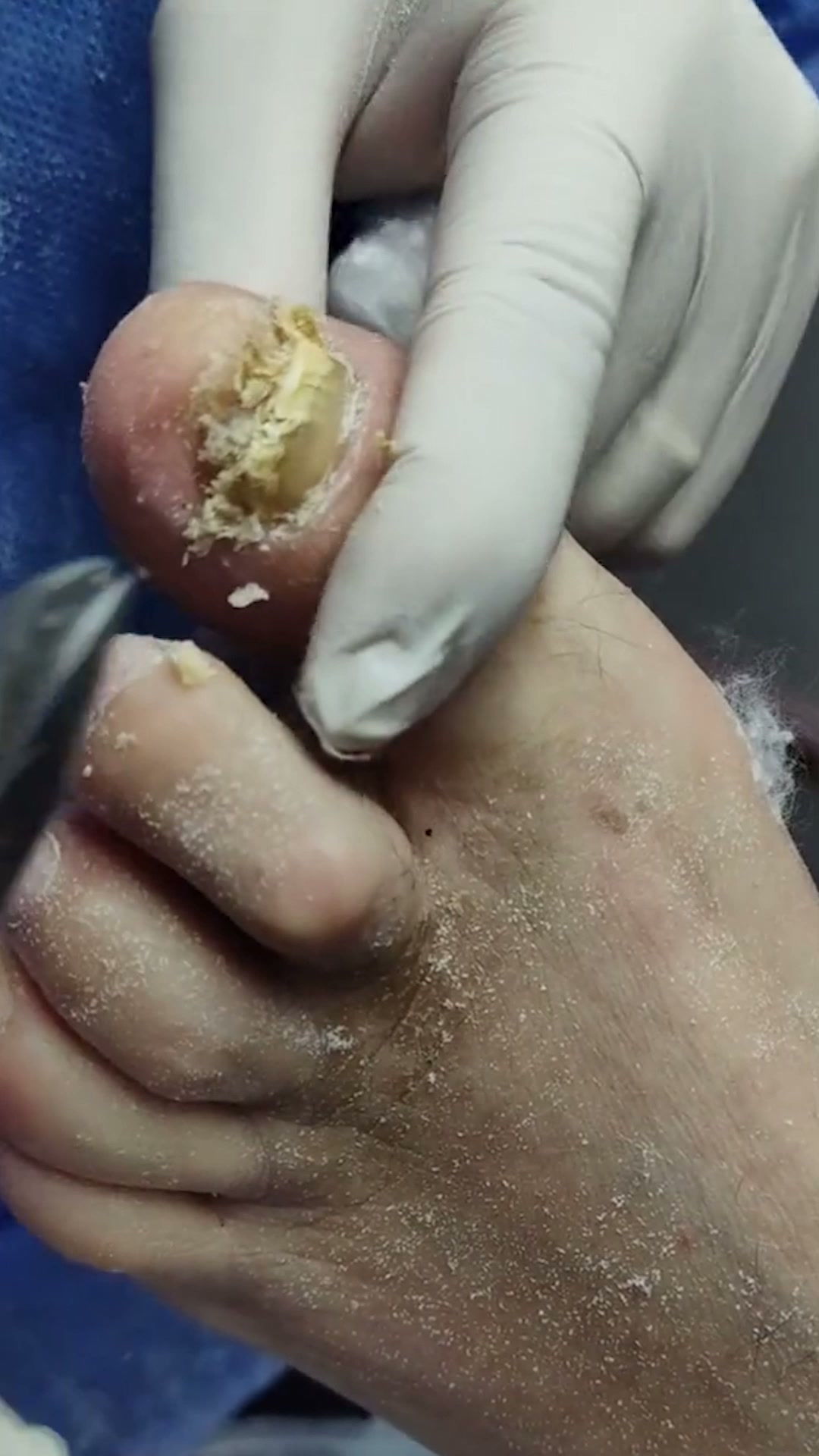 El aceite llega donde la crema no