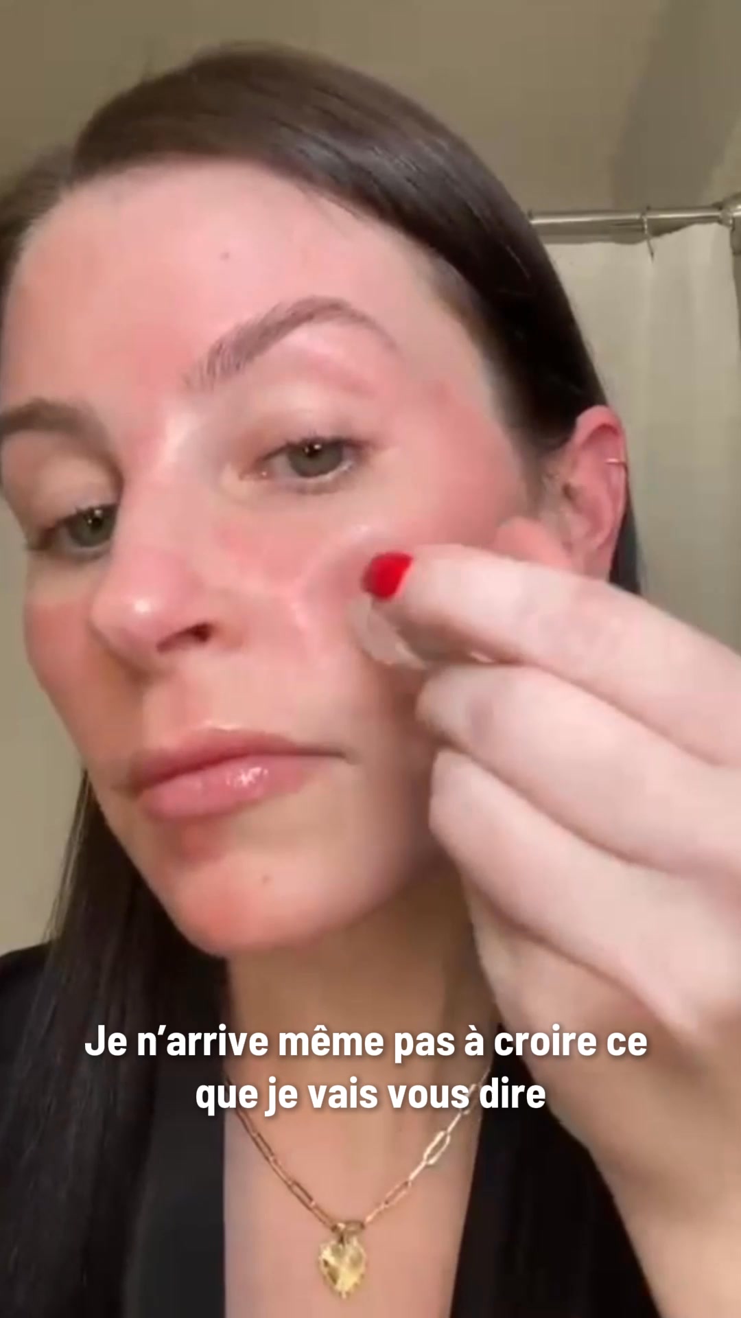 Micro-Infusion : une seconde jeunesse pour votre peau
