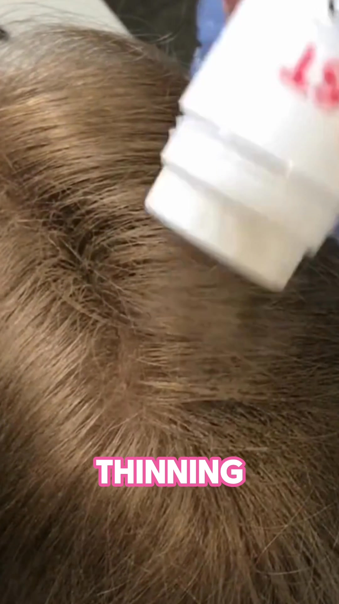 Conceal Hair Loss | Undetectable Hair Fibres for Thinning Hair