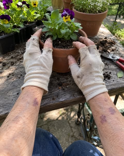 The dermatologist was totally wrong about my arms